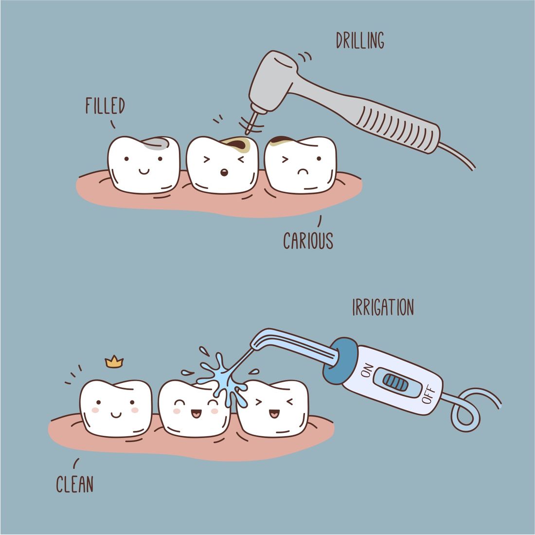 Which filling should I choose for my tooth? - Dentist in Sydney