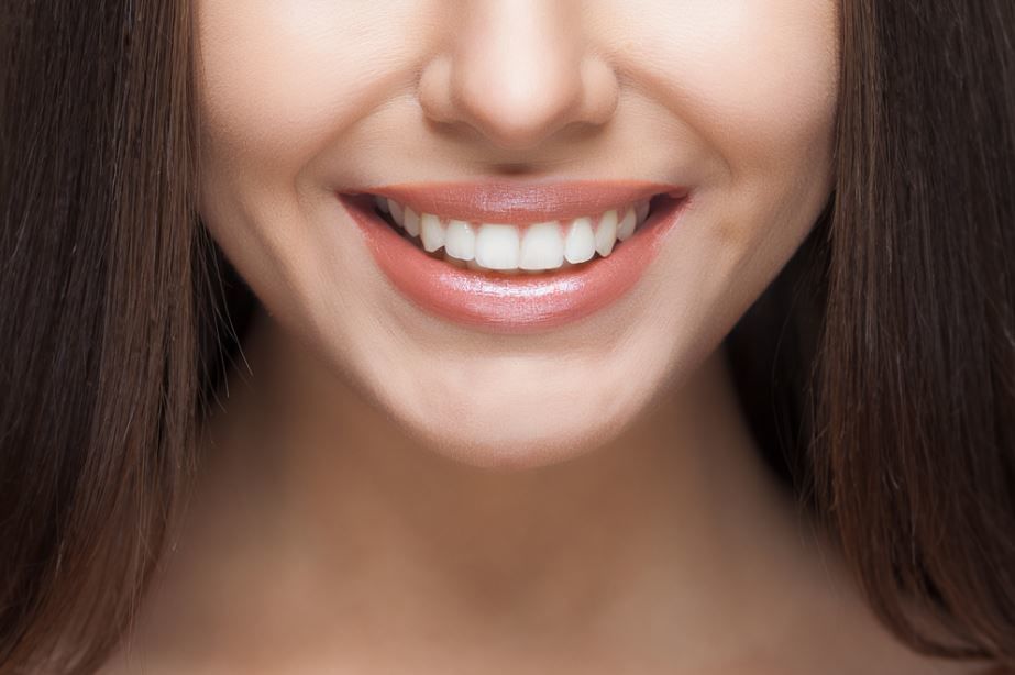 3 Reasons You Should Get Teeth Whitening Done
